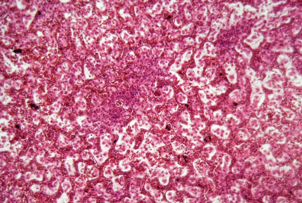 liver cells