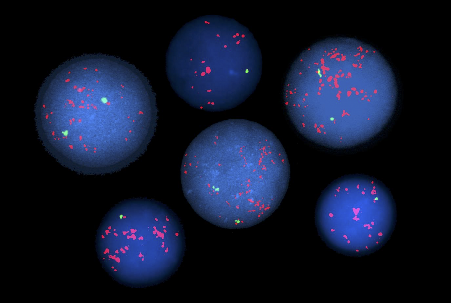 Image shows fluorescent chromosome staining revealing genetic abnormalities in blood cells. Photo credit: Dr. Susan Mathew