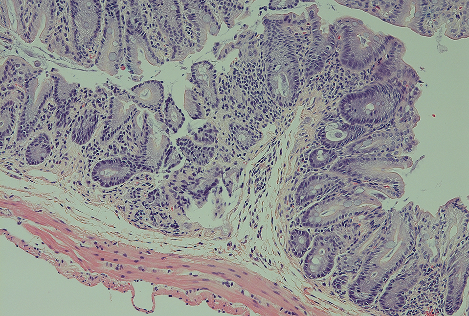 purple and pink stained intestinal cells