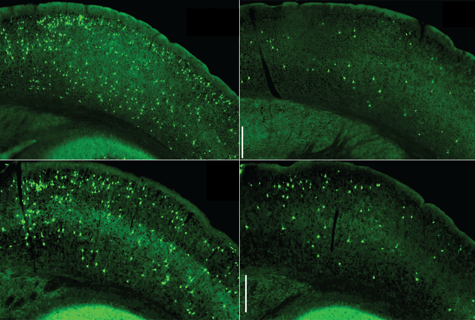microscopic images of brain slices with tau marked
