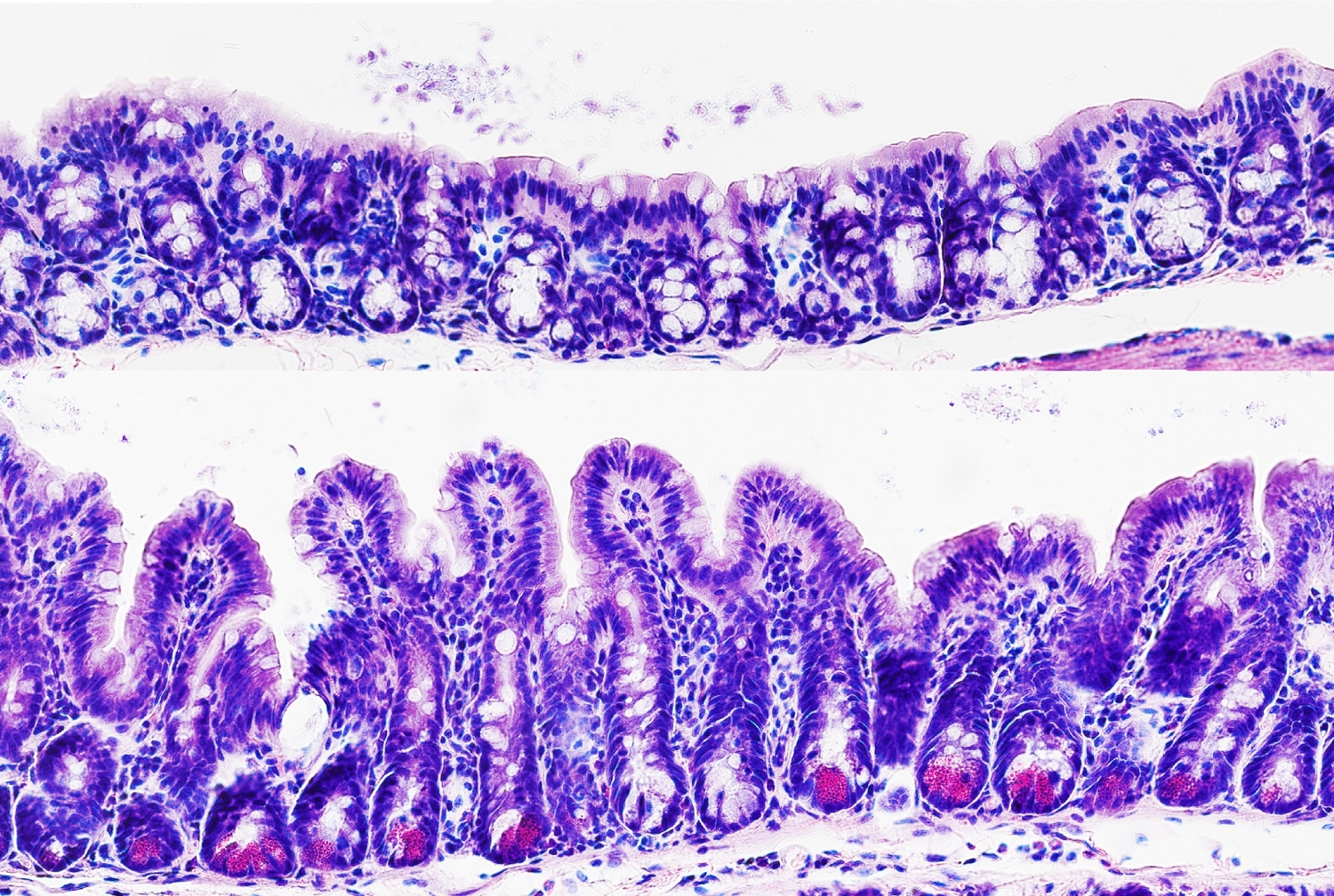 a microscopic image of colon
