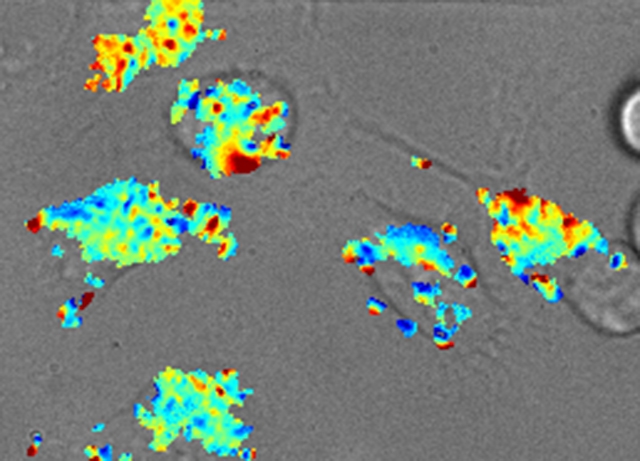 A map of fat content measured by the nano-sensor inside the lysosomes of live cells. Blue indicates fattier and red indicates less fatty