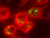 The bacteria that causes tuberculosis infecting macrophages