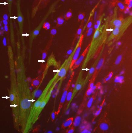 Investigators at Weill Cornell have discovered how to generate large numbers of rare cells in the network that pushes the heart's chambers to consistently contract. Investigators discover how to generate rare cells in the network that pushes the heart's chambers to contract