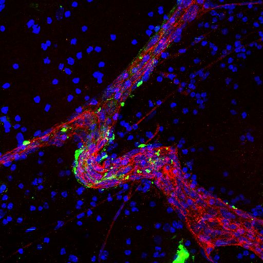 Image of a large blood vessel (red) in brain tissue treated with brain metastatic cell-derived exosomes (green)