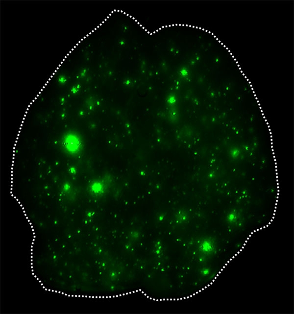 Tumor exosomes in mice lungs