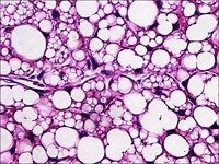 murine beige fat cells