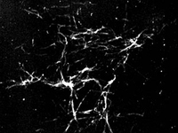 An electron micrograph image shows fibrils of beta amyloid oligomers: toxic proteins in Alzheimer's disease