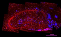 relationship between amyloid plaques in cerebral microvessels of mouse hippocampus