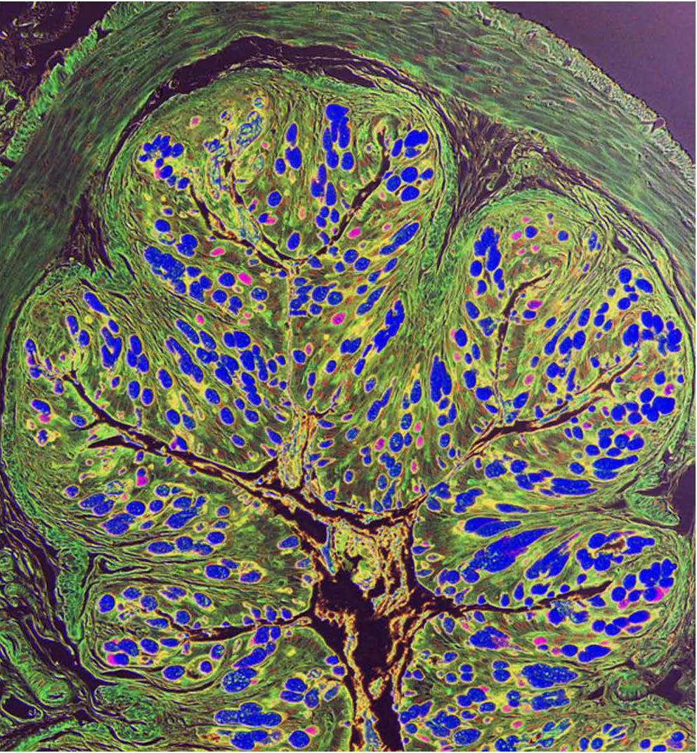 Visualizing the gut. A color-enhanced image of a mouse colon showing the muscular, sub-mucosa, mucosa and epithelial barrier.