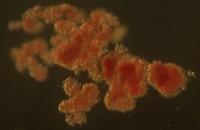 blood stem cells: bone marrow transplantation