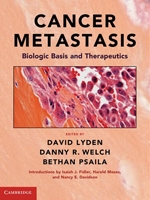 cancer metastasis, Dr. David Lyden