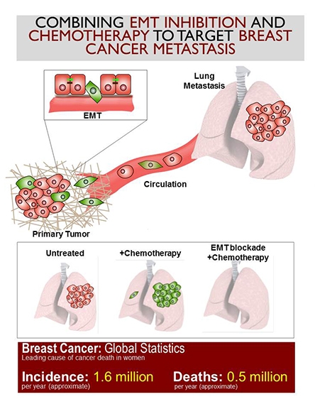 Study Of Breast Cancer Metastasis Upends Conventional Wisdom ...