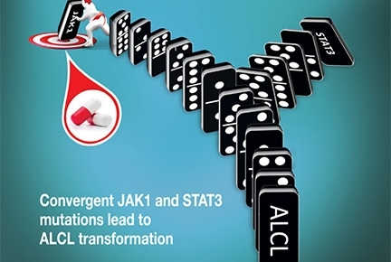 This image illustrates the effect that mutations in the genes JAK1 and STAT3 have in driving tumor growth in patients with anaplastic lymphoma kinase-negative anaplastic large cell lymphoma. These mutations are especially powerful when both genes are acti This image illustrates the effect that mutations in the genes JAK1 and STAT3 have in driving tumor growth in patients with anaplastic lymphoma kinase-negative anaplastic large cell lymphoma. These mutations are especially powerful when both genes are acti