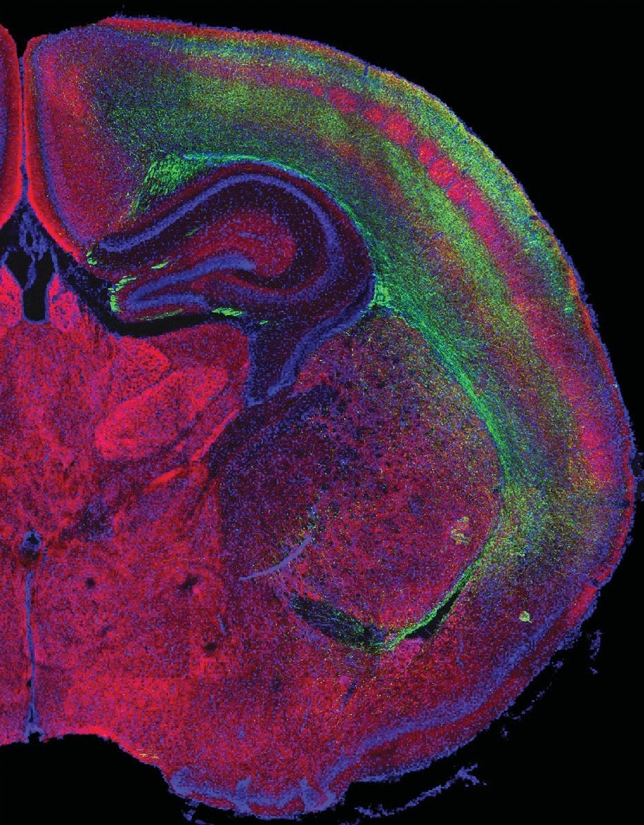 With Feeling: The cerebral cortex’s receptive areas for the sense of touch (depicted in red) are seen surrounded by neural cell projections (green).