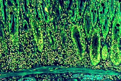 inflamed mouse intestine with longer epithelial cells and an over-abundance of immune cells 