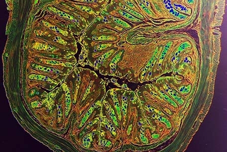 intestinal tissue damage of intestinal inflammation