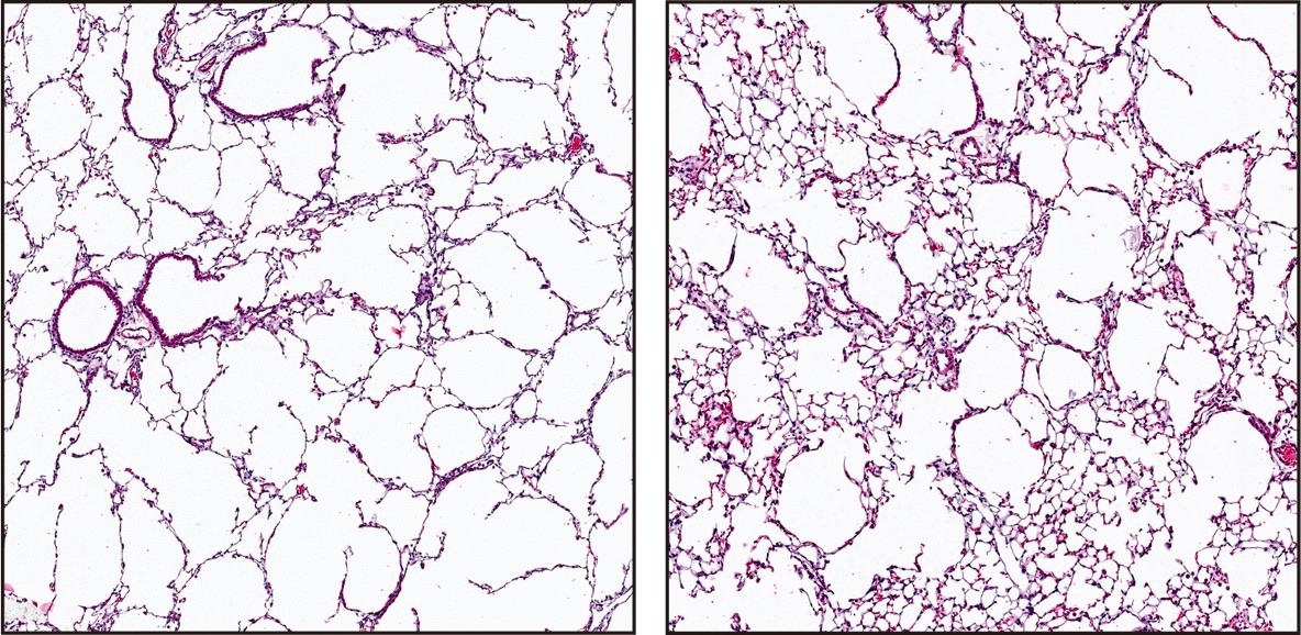 histology of lung tissue from normal mice and those with COPD