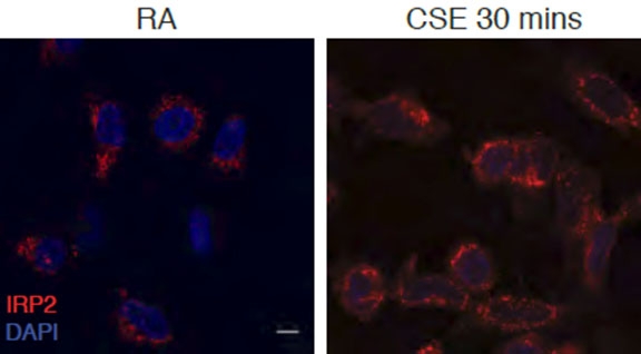 Epithelial cells in airway