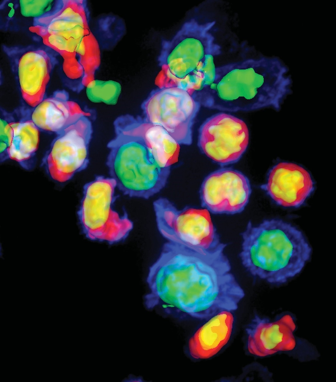 on the offensive: So-called “killer” T-cells (seen in pink and yellow) attacking cells that are infected with HIV (seen in blue and green). Photo: Sudha Kumari