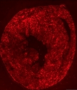 Mouse heart after being treated with gene therapy. The red stain demonstrates that the cells are expressing the protein frataxin, crucial to the proper functioning of mitochondria, the cells’ power plants. Mouse heart after being treated with gene therapy.