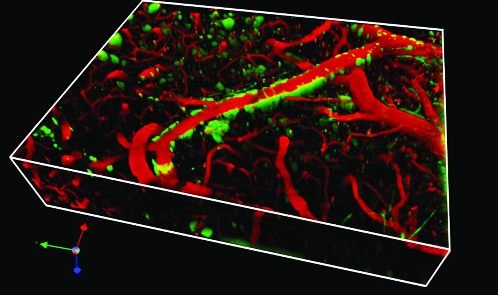 Blood vessels in mouse brain