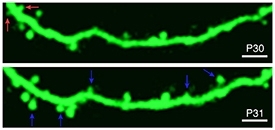 Adolescent Prefrontal Cortex