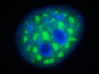 . Toxic RNAs in nucleus