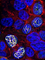 The SRF pathway: the invasion of cancer cells into normal tissue —  MICAL-2 reorganizes actin in the nucleus