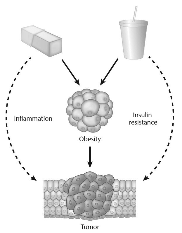 VICIOUS CYCLE: An illustration of how fatty and sugary foods, such as butter and soda, can fuel obesity, inflammation and insulin resistance—potentially feeding cancers