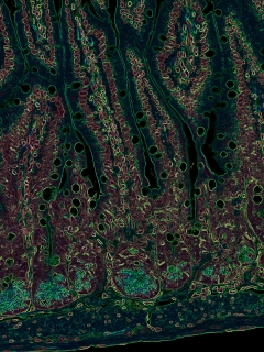 color-enhanced microscopic image of a mouse intestine demonstrates the presence of the immune system and intestinal barrier. 