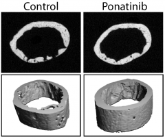 CT of femur of NF mice treated with ponatinib or not