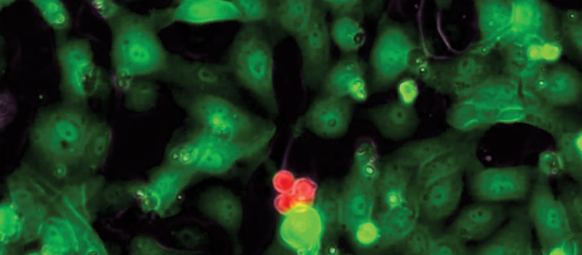 Hematopoietic stem cells (in red) expanding as a colony on the vascular niche (green). Image credit: Weill Cornell Medicine